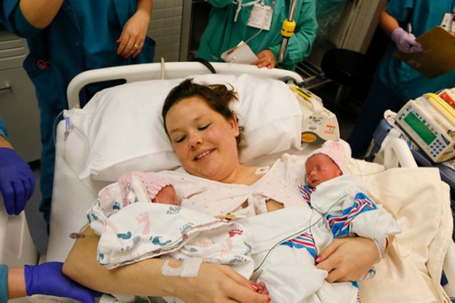 Неразлучные двойняшки, державшие друг друга за руку при рождении, два года спустя