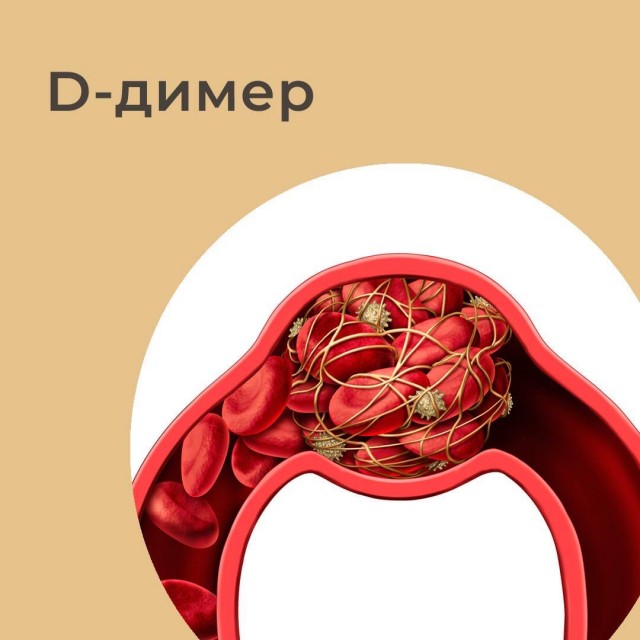Пандемия. Коронавирус и съехавшие крыши. Россия и мир. Часть 31.