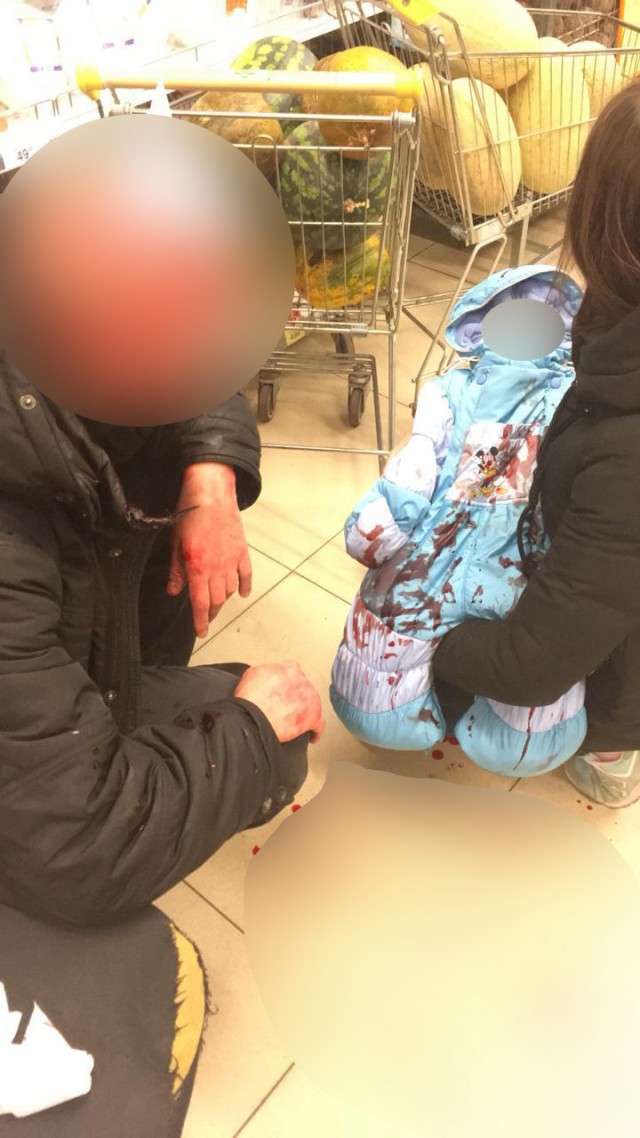 «Неадекват с битой»: на севере Москвы избили пешехода и младенца