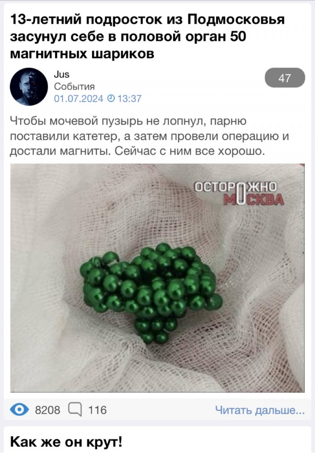 13-летний подросток из Подмосковья засунул себе в половой орган 50 магнитных шариков