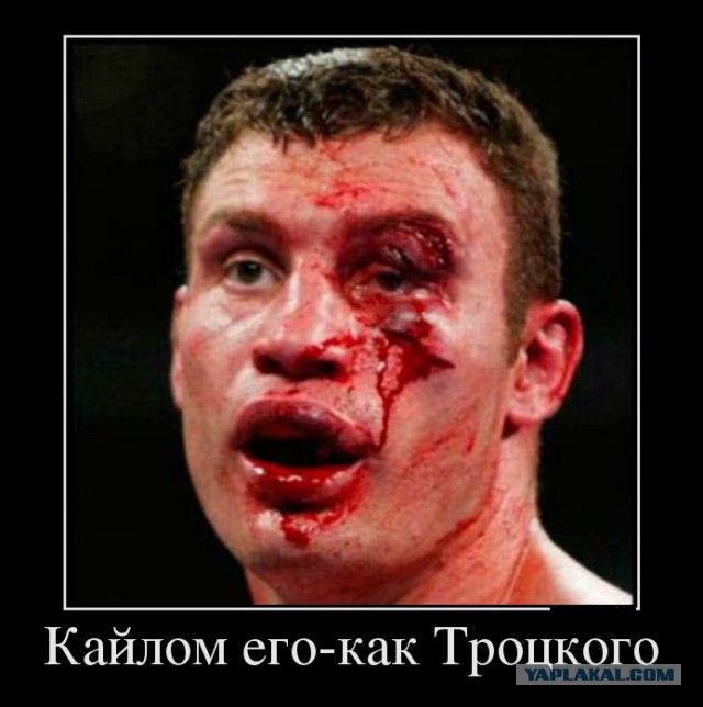 Кличко тупит у Познера