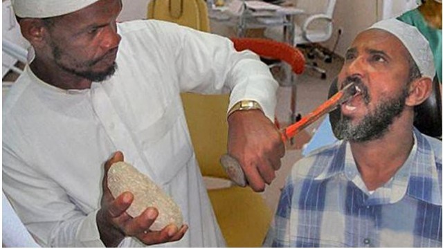 Турецкий стоматолог завинтил зубной имплант в мозг