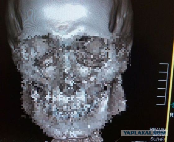 Врач о пациентах с его ночного дежурства