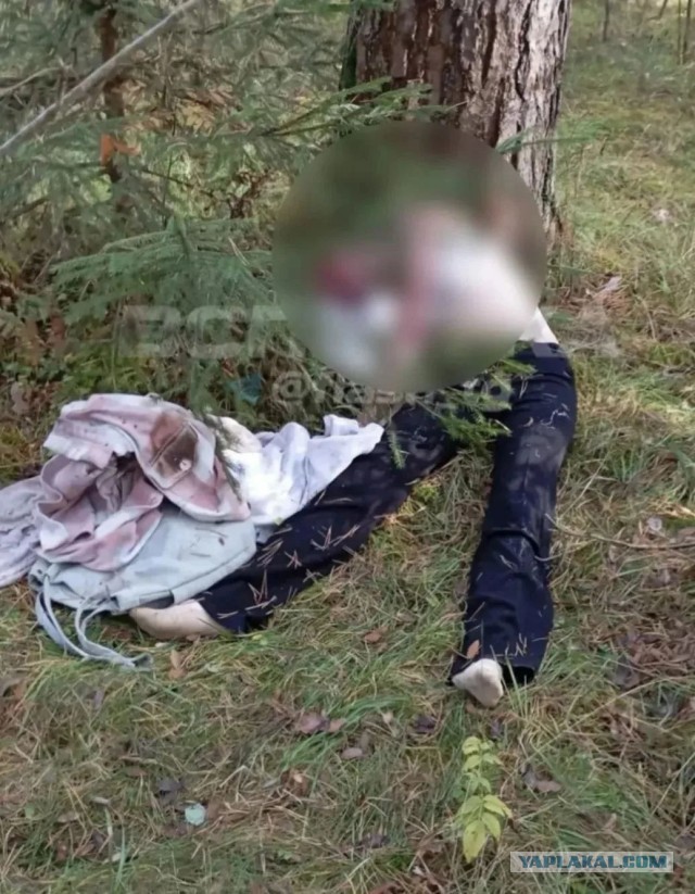Избили, обрили и подожгли — жестокую расправу из-за ревности устроила семья над девушкой во Владимирской области