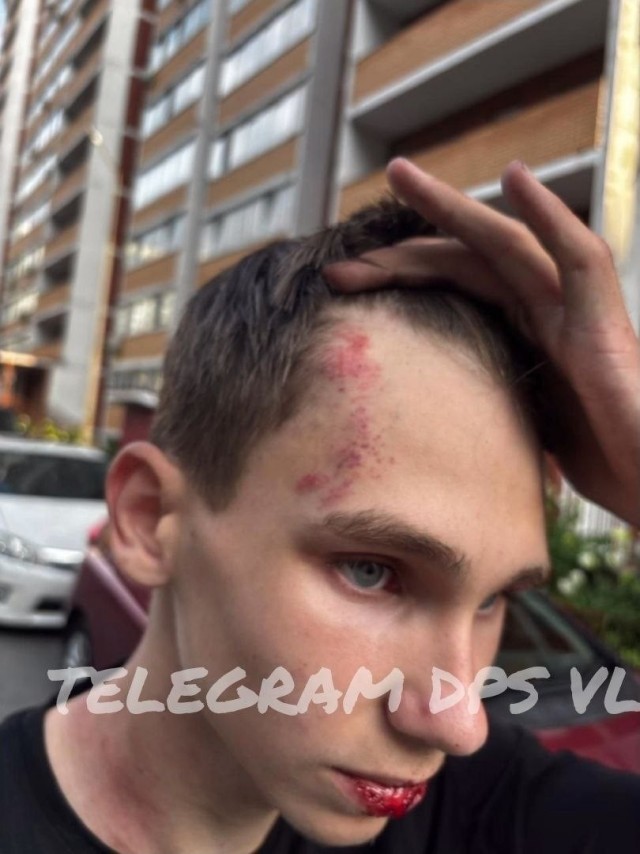Во Владивостоке 15-летнего подростка избил мужчина, которого очевидцы называют сотрудником полиции.