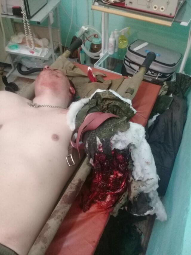 Взорвавшийся в стволе Ак-74 патрон оторвал руку офицеру на стрельбах Минобороны