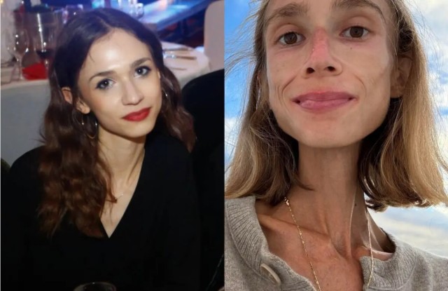 На Бали от истощения умерла женщина из Польши
