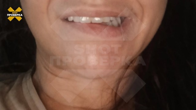 У женщины перекосило рот после коктейля «Монако»