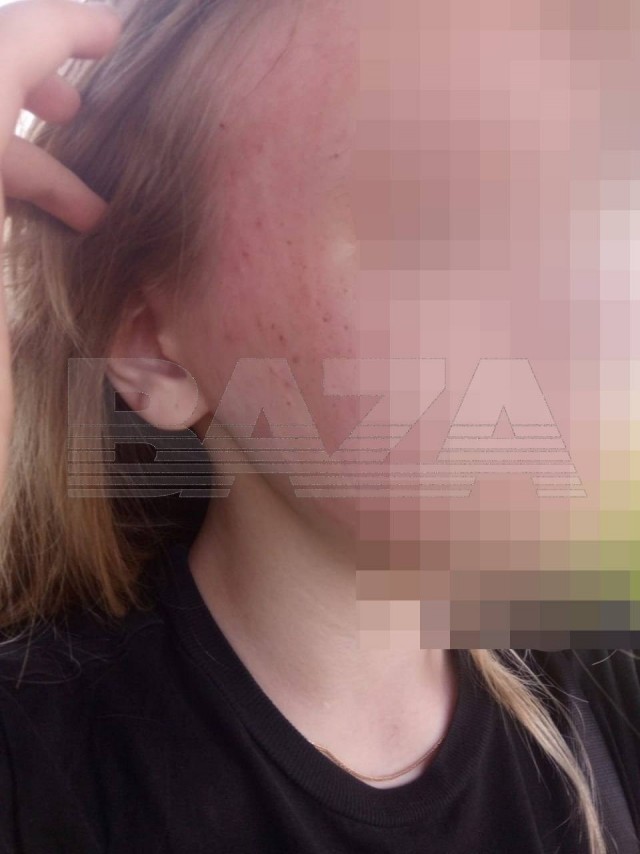 Водитель избил и выгнал школьницу из автобуса, заподозрив в том, что девочка не оплатила проезд