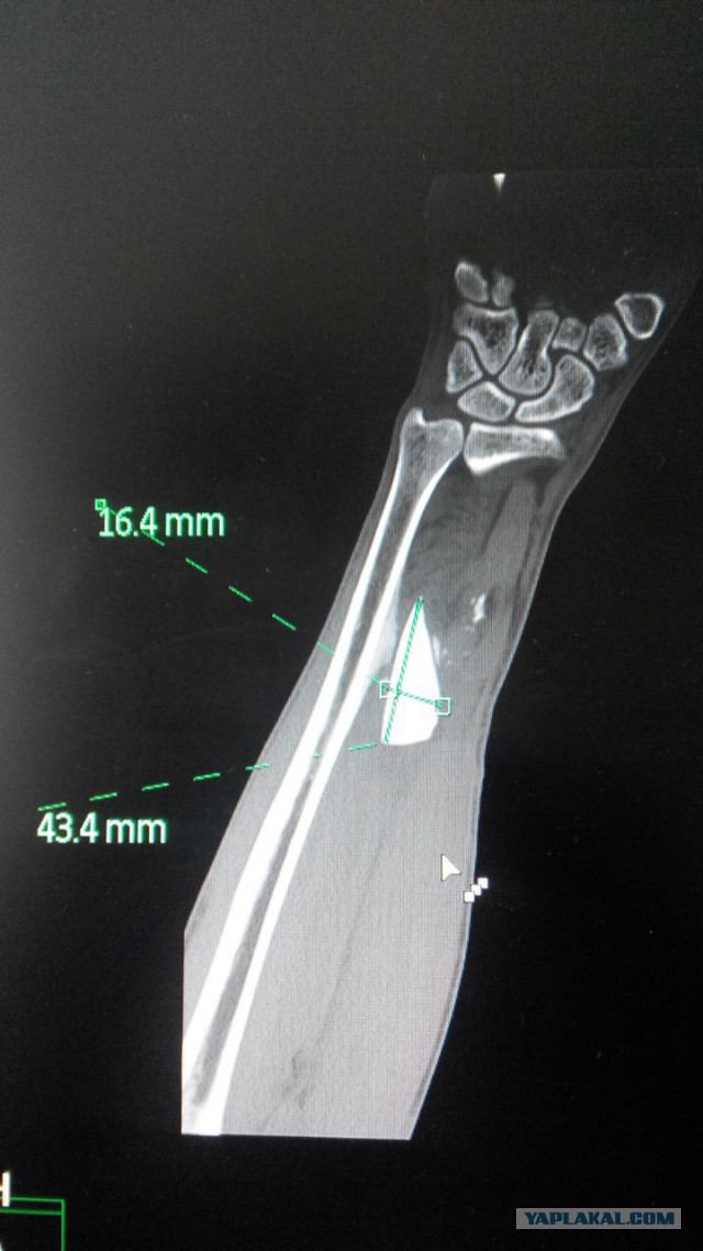 I need help! найти вора или то что он украл.