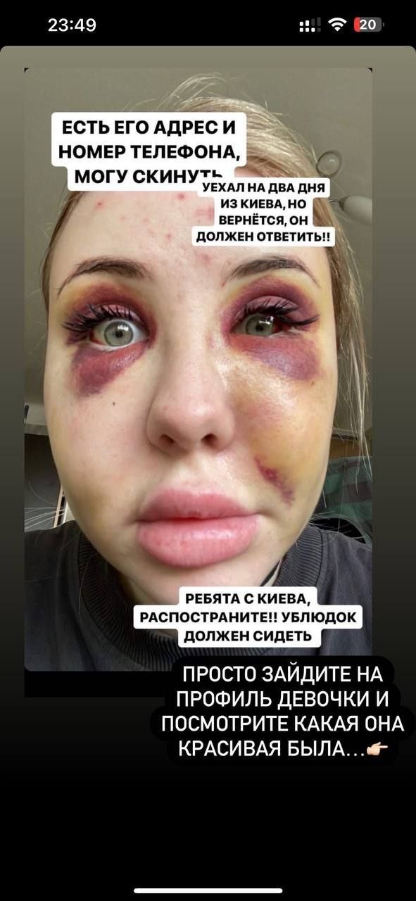 Парень узнал что его любимая изменила ему в клубе с турком и вот что из этого вышло.....