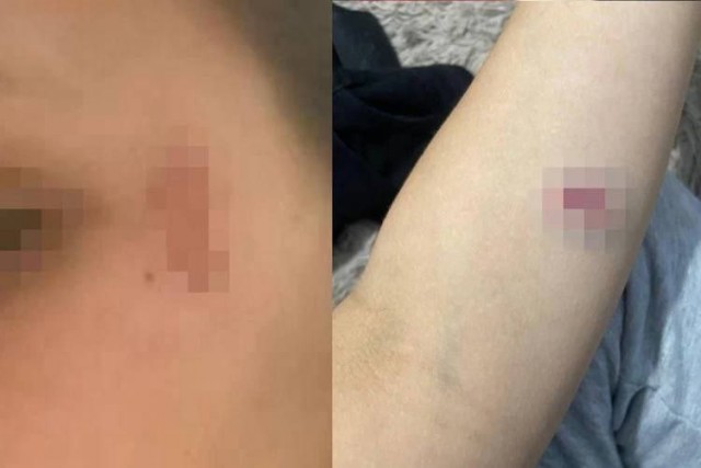 В Новосибирской области курьер избил мать и дочь, которые не пропустили его в подъезде