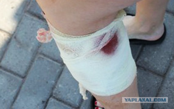 В Липецкой области бобр напал на девушку