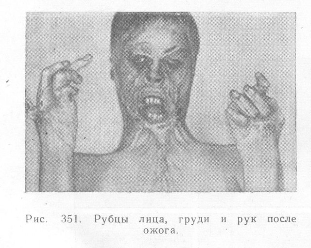 Нас извлекут из-под обломков, поднимут на руки….