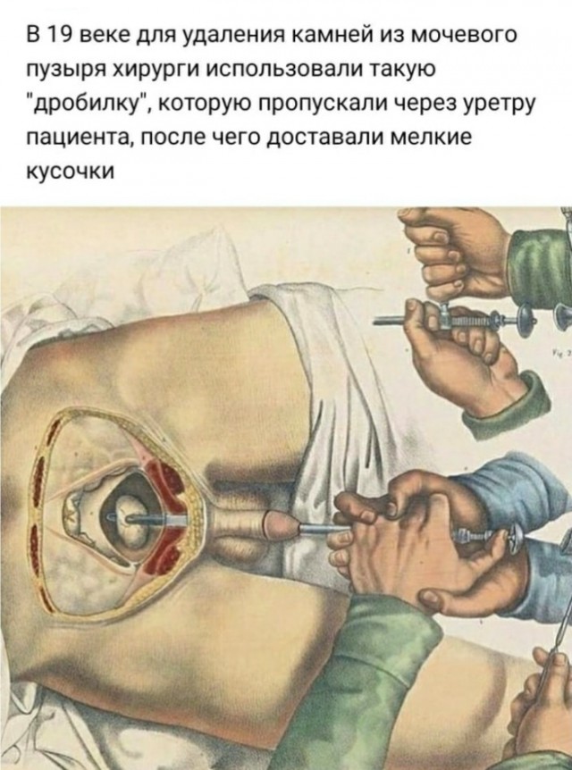 Бредзона 15.02.21