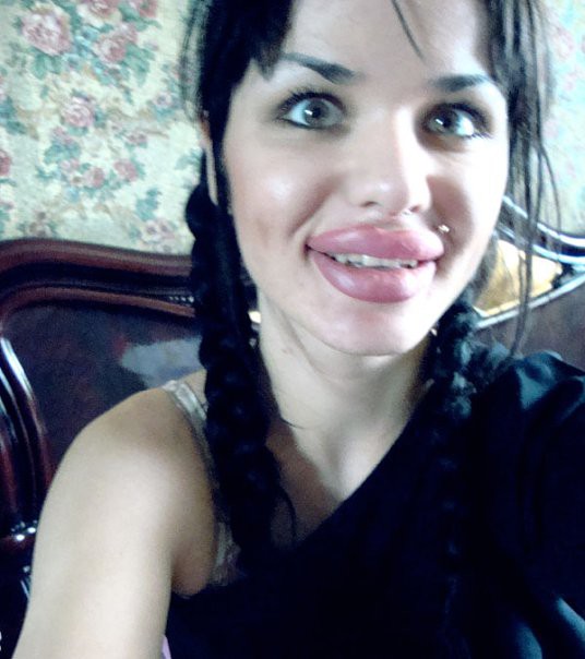 Опять соцсети, опять фотографии