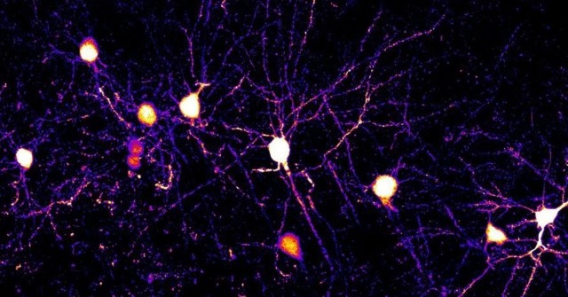 Нейробиологи впервые зафиксировали процесс обучения мозга под микроскопом