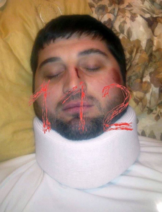 В Ингушетии произошло покушение на Илеза Нальгиева, бывшего начальника полиции Карабулака, который отбывал наказание за пытки задержанного