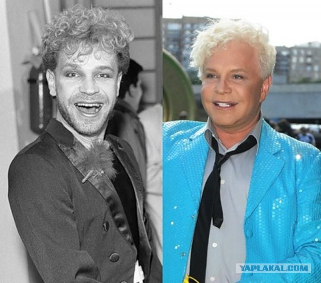 Знаменитости, которые безобразно стареют