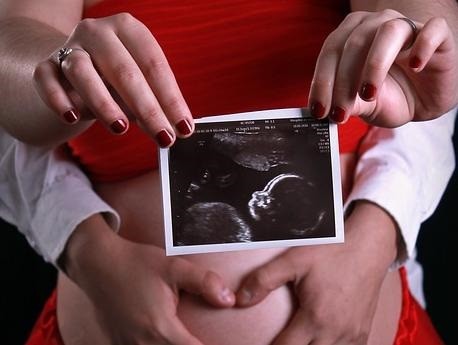 Депутат предложил запретить аборты без согласия отца