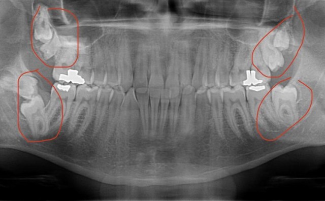 33 удивительных и уникальных фотофакта со всего мира