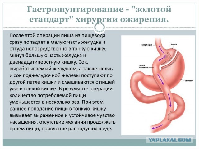 «Она много жрет, зашейте ей рот»: девушка сбросила 58 килограммов