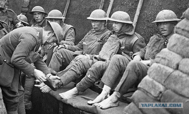 Окопная болезнь