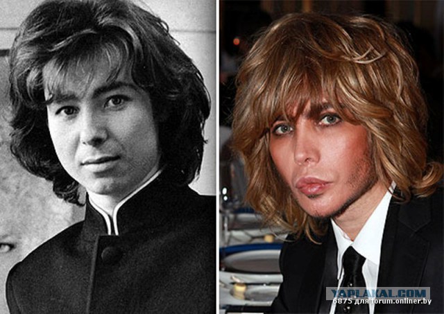 Знаменитости, которые безобразно стареют