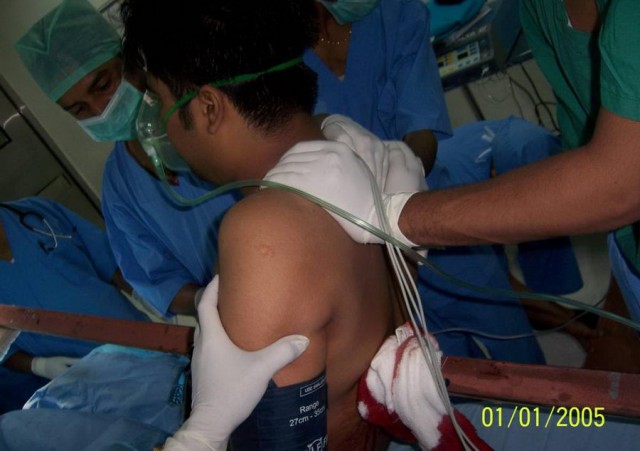 Португальский парень чудом выжил, после того как его проткнуло железякой