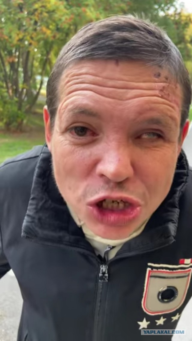 Егорка или "Как жить то бл*?!"