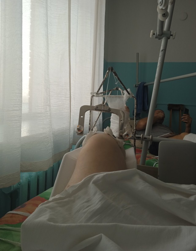 Сказ о том, как я шел домой и сломал ногу в двух местах