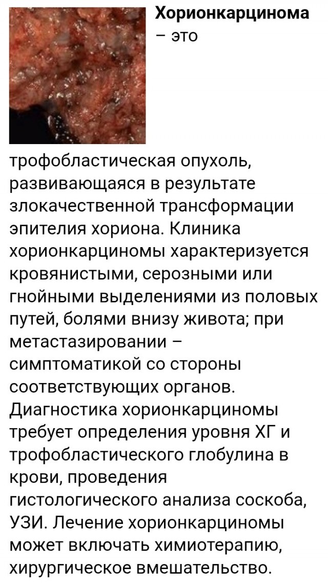 Диагноз за минуту