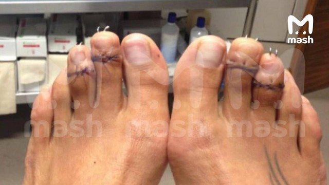 2026-й ворвался с двух ног. Переломанных и прооперированных