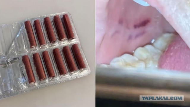 Китаянка перепутала конфету с петардой, и та взорвалась у нее во рту