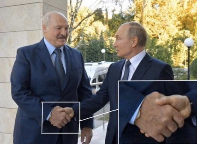 Что у него с рукой?