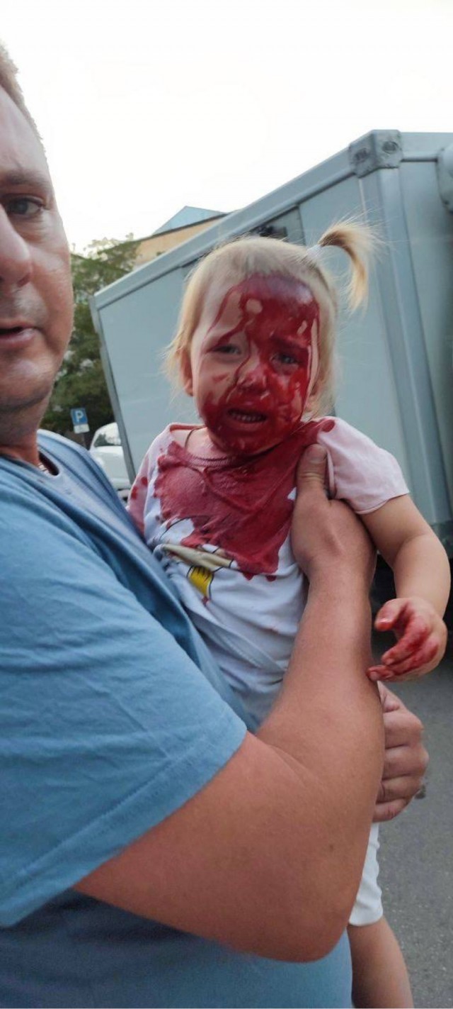 В Крыму дочь местного депутата сбила на самокате ребенка в парке, после чего поехала кататься дальше