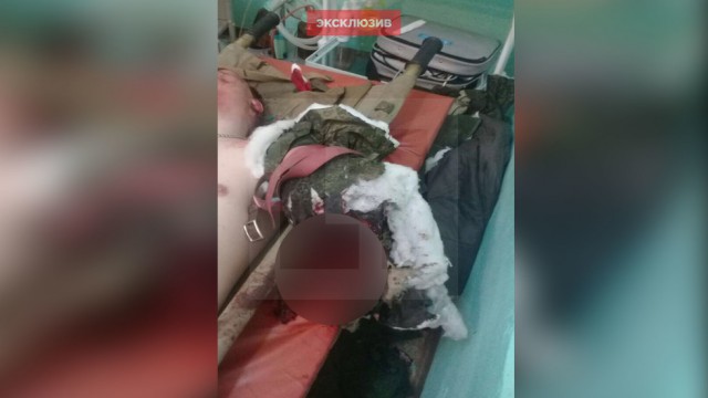 Взорвавшийся в стволе Ак-74 патрон оторвал руку офицеру на стрельбах Минобороны