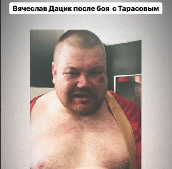 Националист Дацик проиграл бой блогеру Тарасову
