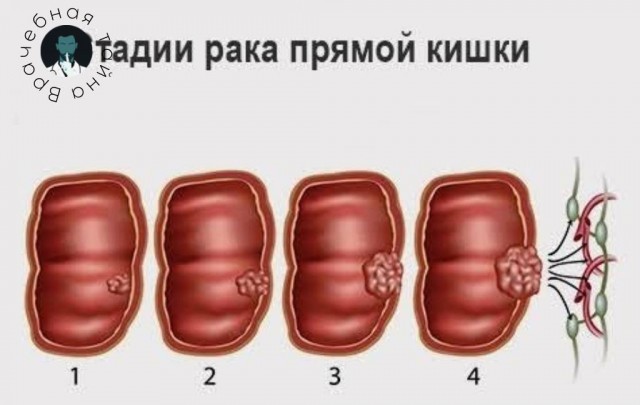 Пандемия съехавших крыш - разновидности болезни. Россия и мир. Часть 42.