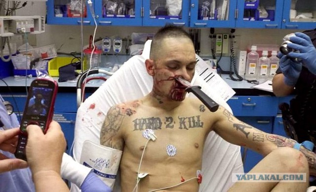 Медики не смогли спасти мужчину из-за его татуировки