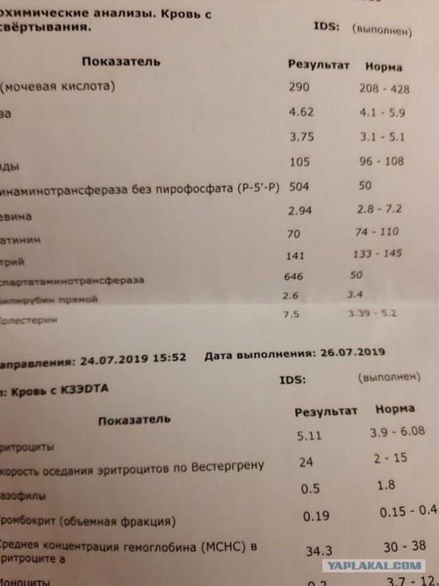 Печень и с чем её едят