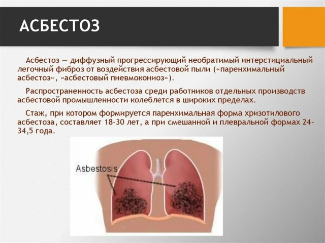 15 познавательных фото, пропустить/проигнорировать которые — значит не узнать что-то новое