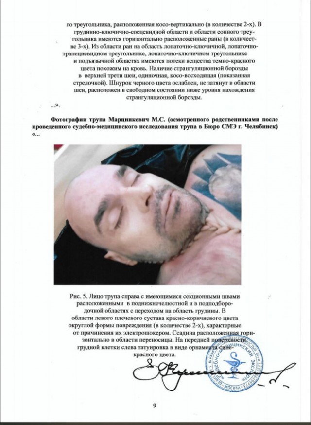 Экспертиза возможного убийства Тесака в Челябинском СИЗО №3