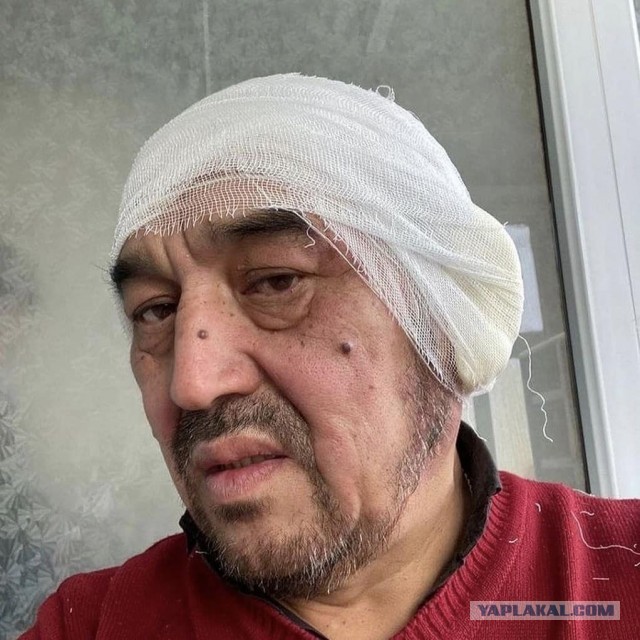В Караганде мужик на трассе отморозил уши