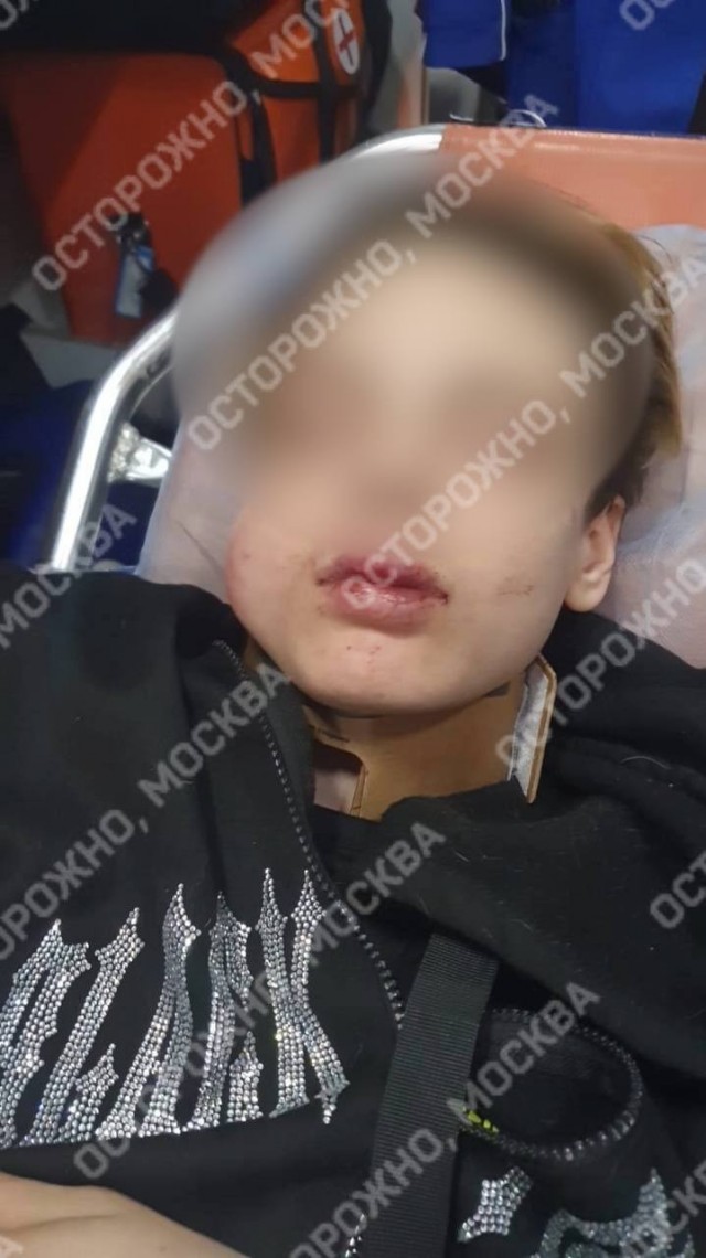 На севере Москвы подростка избили толпой за интимную фото 14-летней девушки соседа