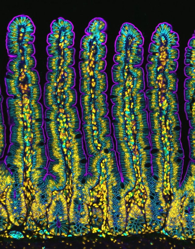 Жизнь под микроскопом: 11 победителей фотоконкурса Nikon Small World 2024