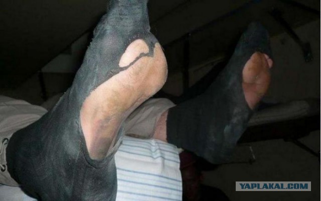 Боковушка. Плацкартный вагон