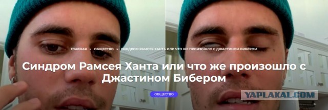 Пандемия съехавших крыш. Разновидности болезни. Россия и мир. Часть 36