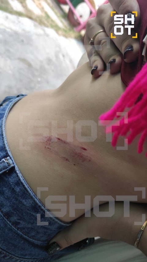 На россиянку напала обезьяна в первый же день отдыха во Вьетнаме.