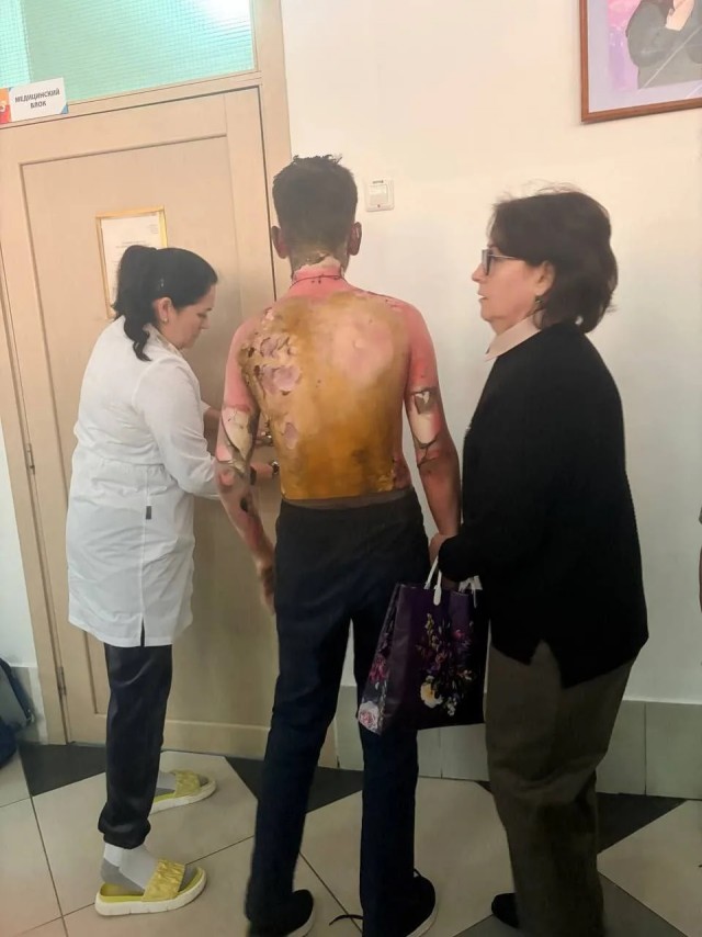 В Красноярске восьмиклассница облила бензином и подожгла одноклассника